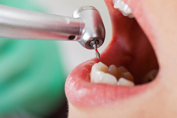 Best Pediatric Emergency Dentist in Campbell, FL
